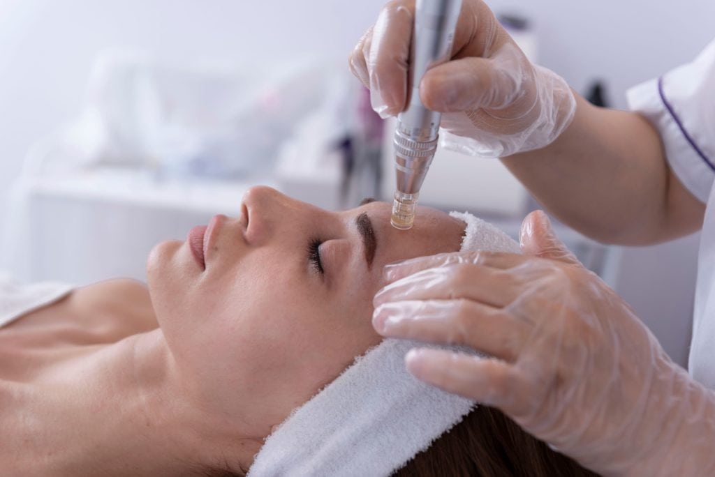 How Long Does it Take To Heal From Microneedling?